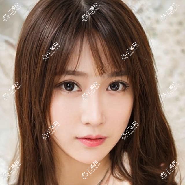 烟台丰面颊价目单2025年当前揭晓,含丰印堂/自体脂肪丰面颊/微晶瓷丰面颊玻收费明细