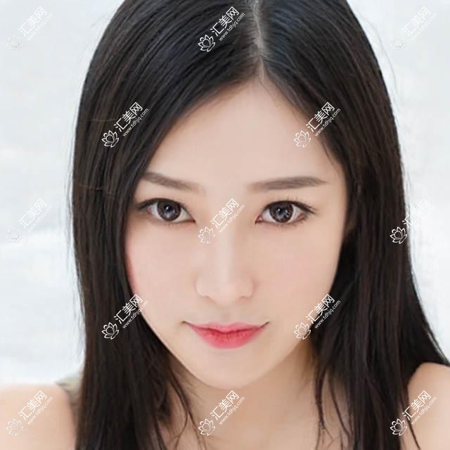 邢台整形医生排行更新!魏圣昊、李灵玲以精细技艺带领美肤抗衰潮流!