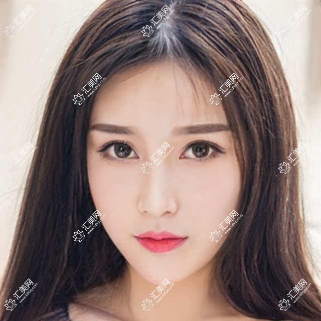 成都市棕南私密医美门诊私密整形费用揭秘:紧致手术约2W+ 私密漂红近1W+ 激光脱毛数千起