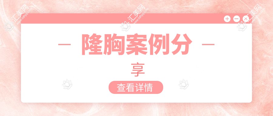 隆胸案例分享