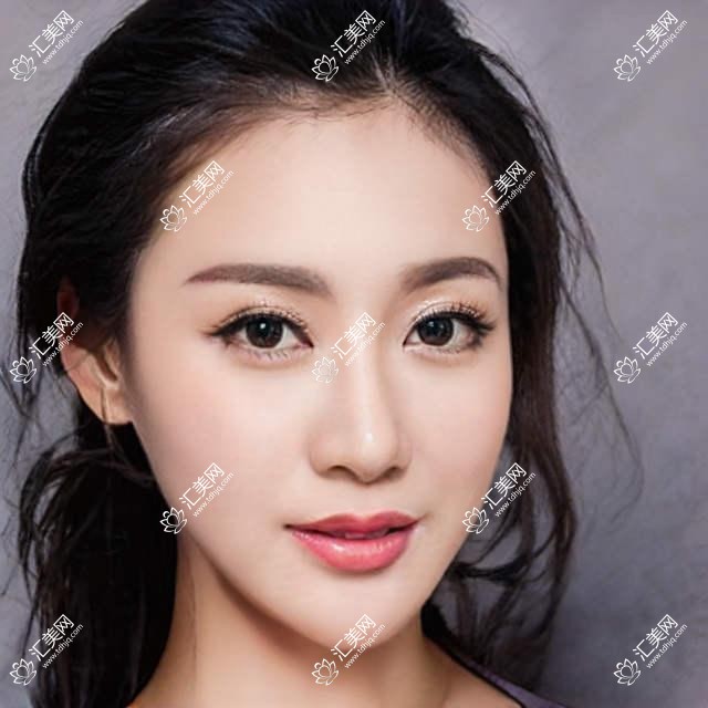成都星美宝岛整形项目价目表:全切双眼皮6K+ 隆鼻1.5W+ 吸脂2W+