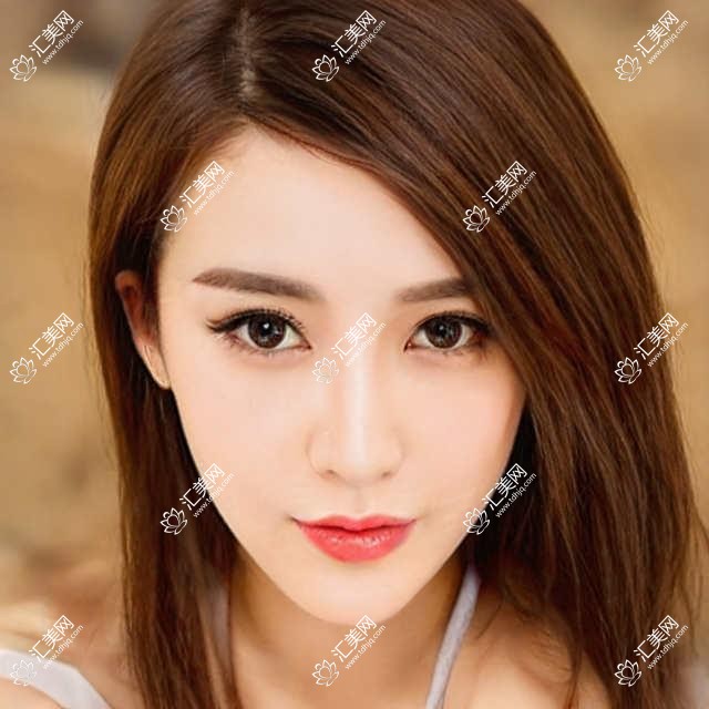 柳州电波拉皮去法令纹排行前10医院名单+价格价目表展示!技术好医术精细