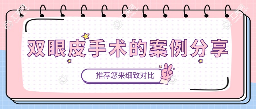 双眼皮手术的案例分享