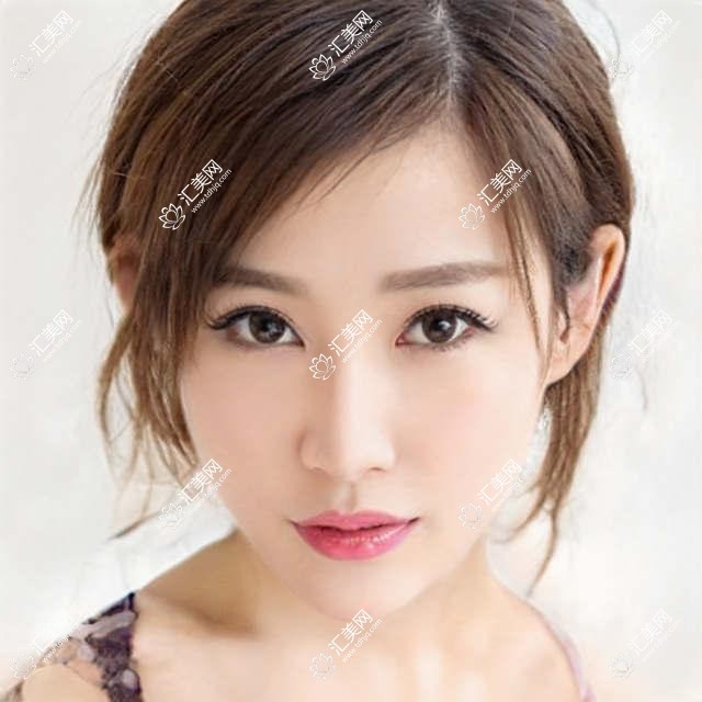 上海市中视眼视光眼科门诊部角膜塑形镜价格揭秘?OK镜约8K-1.5W/RGP镜片6K-1.2W/多焦点软镜4K-8K