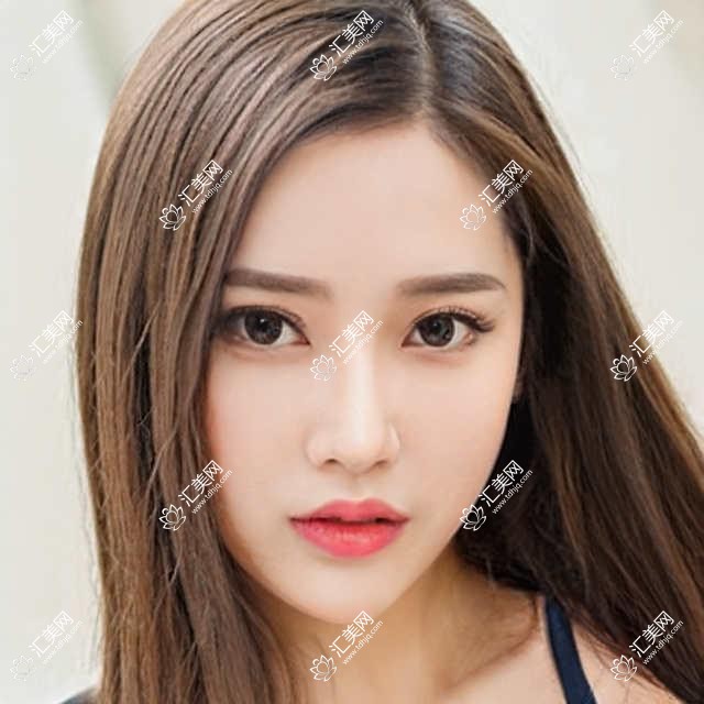 成都美极医美门诊全项目价格表:去黑眼圈2k+