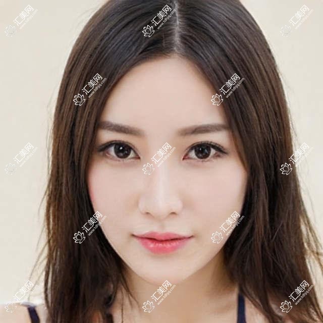 成都高新后美医美医院价格揭秘:热门、热玛吉项目费用一览