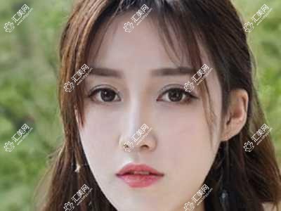 贵阳开阳县医院丰印堂多少钱?丰印堂970元