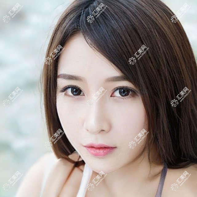 武汉武昌艾格眼科全项目价格揭秘:近视激光&白内障手术费用一览