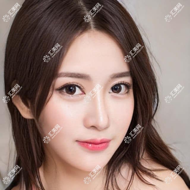 武汉中翰整形医美价格揭秘:热门项目如隆鼻丰唇费用一览