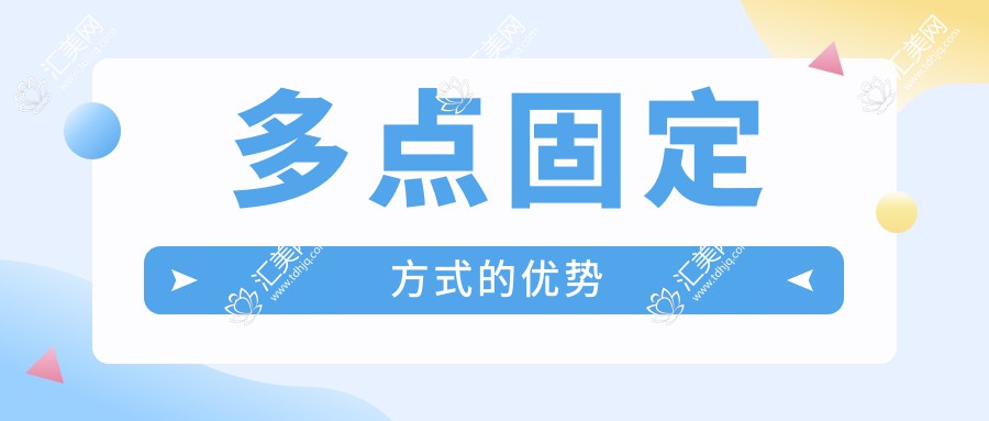 多点固定方式的优势