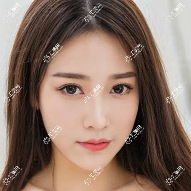 天津医美亦可美客全项目价目公开！丰胸29800起，性价比之选，安心变好看无负担！