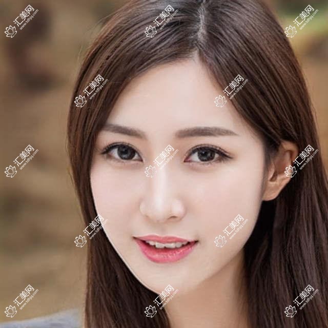 乌鲁木齐E光除皱前十排行及价格含热玛吉4代/射频除皱/胶原蛋白除皱价格搜集整理