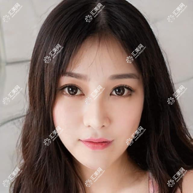 天津河西坤如玛丽整形价目表公开 双眼皮8K+隆鼻1.5W+皮肤管理5K+
