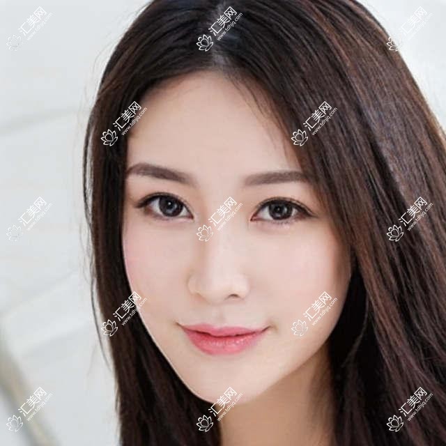 烟台地区微整形医生董春姬张苹金裕仁推荐项目详解,眼部整形谁更受欢迎?