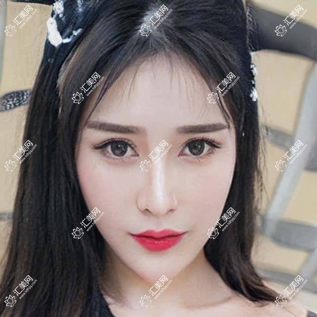 北京小美微针轻医美揭秘:&玻尿酸&项目价格大公开!