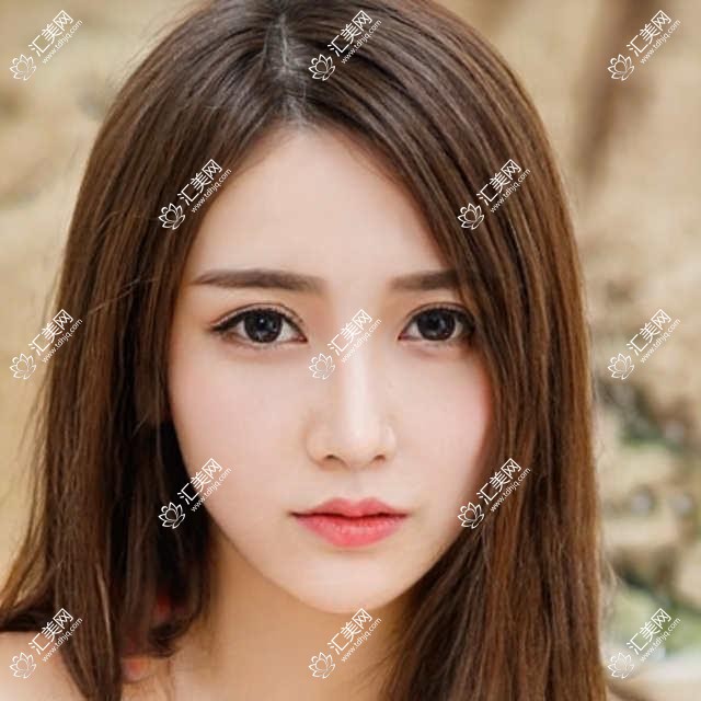 呼和浩特亚太医美脂肪项目费用揭秘:吸脂约1W+ 丰唇/面填各2K+