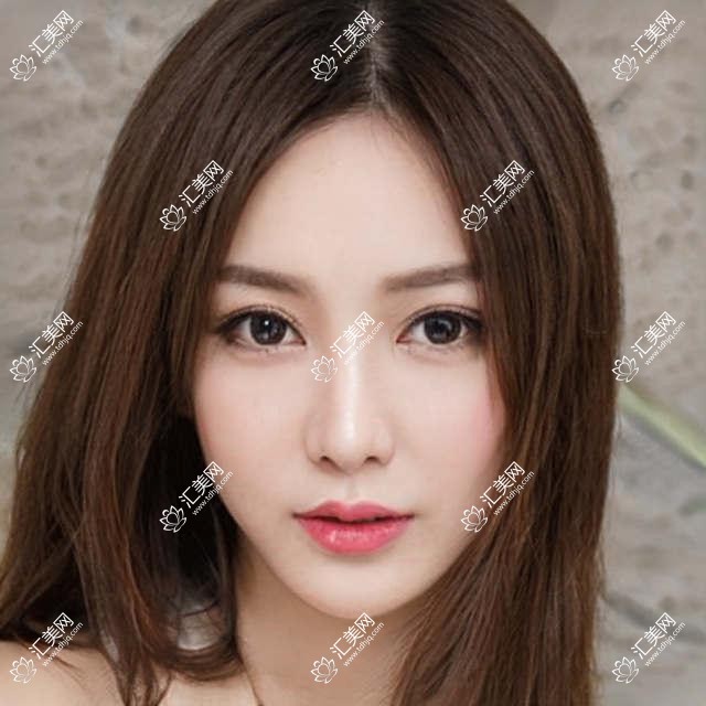 绵阳隆胸及私密整形名医推荐:吴承勇、赵波领衔,技术精细受赞誉