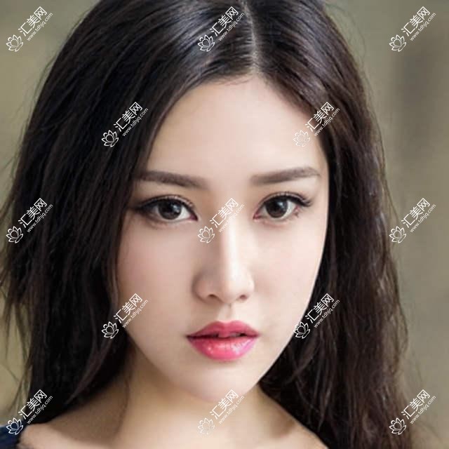 上海九龙私密科医院项目价格大全:眼整形2999+