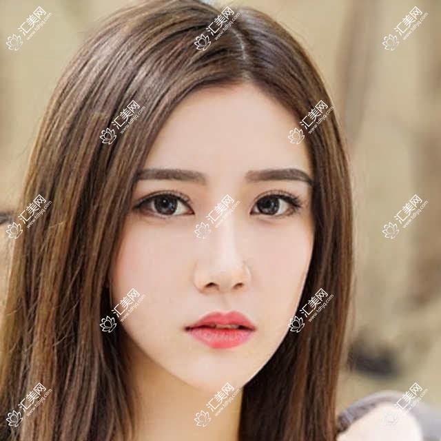 咸阳地区医生排行榜揭晓！韩系翘睫无痕双眼皮、吸脂塑形医生齐聚，技术、口碑双在线！