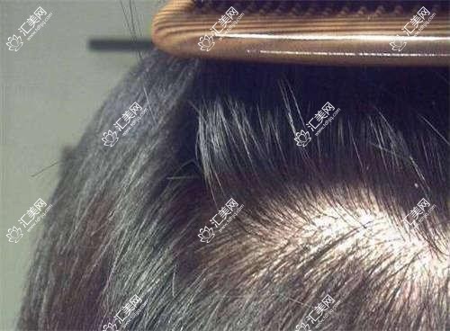 珠海抗衰老医生排行揭晓!擅长埋线提升、价格透明,医院地址全攻略!