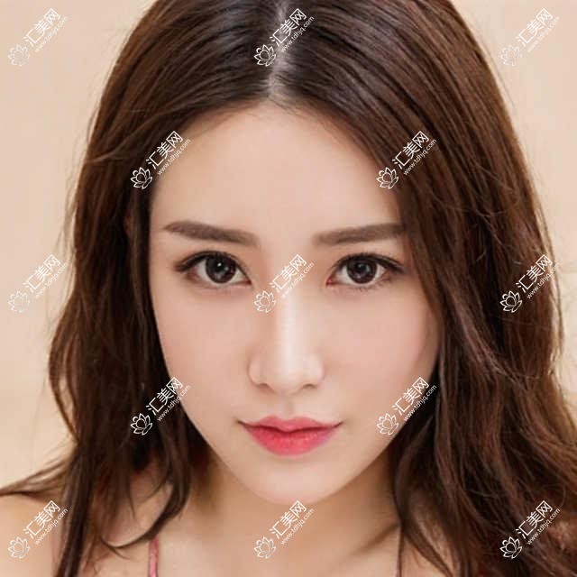 深圳医恒美美容医院价格大全:吸脂塑形6K+