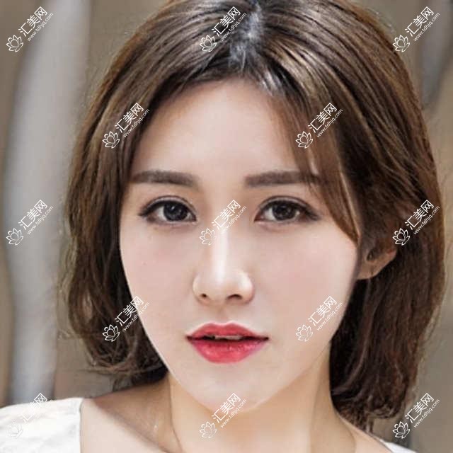 武汉伊妍医美项目价目表曝光!隆胸仅需29800元起,性价比超赞,安心变好看无负担!