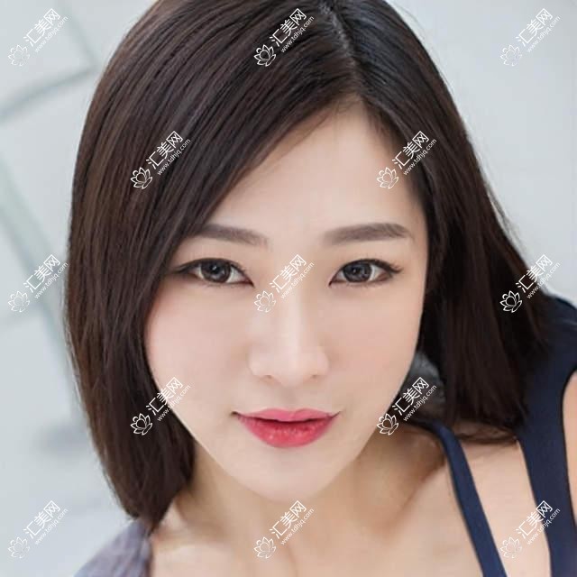 兰州价格表2025:E光美白价格3158元,激光美白2k元起