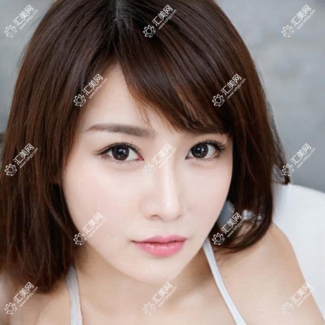 肇庆牙齿矫正及种植医生榜揭晓!美学修复,隐形正畸,种植全攻略!