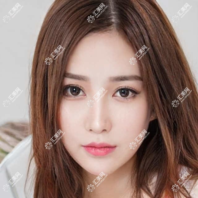 大理诚康口腔项目价目表揭晓:全项透明,种植牙单颗低至6800起!
