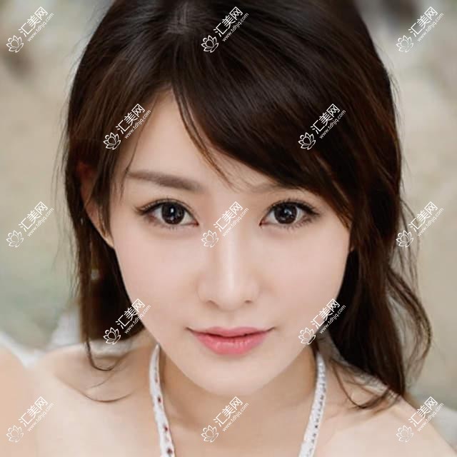 威海牙齿美白修复优选哪位医生?郝悦言、宋鹏、汤丽超技术精细受推崇