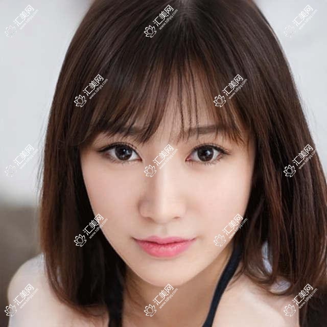上海市江苏南京吴根元口腔费用揭秘?牙齿矫正2W+ 种植牙1W5+ 美白套餐3K+