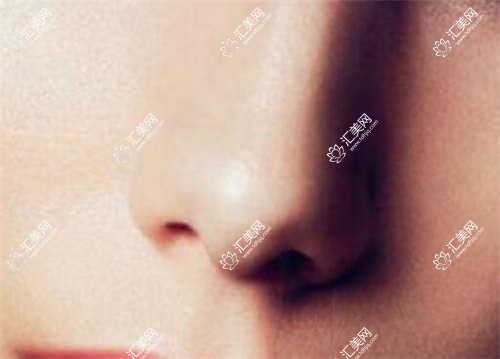 成都思迈口腔全项目价格揭秘:牙套矫正实惠+活动义齿详询+种植牙实惠价+牙齿美白超值体验