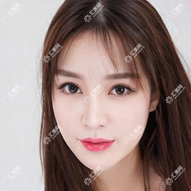 北京佳美口腔全项目价格表:全瓷牙/种植牙详列,实惠价格一览