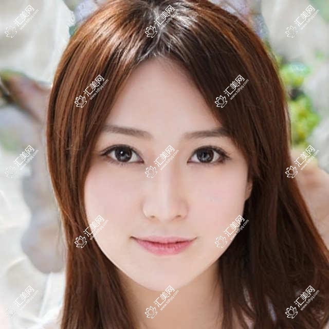 泰安地区口腔种植医生推荐榜(含全口/半口种植+即刻种植技术)_泰安种牙优选