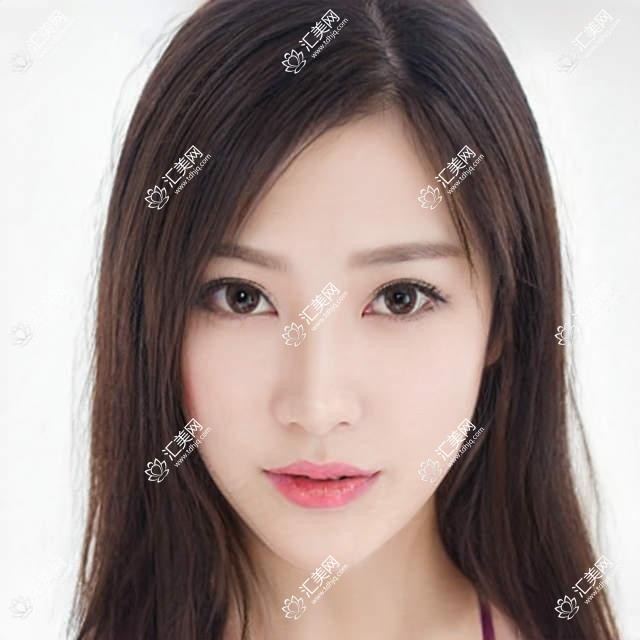 西安口碑医生推荐:烤瓷牙正畸医生排行榜,修复美牙参考