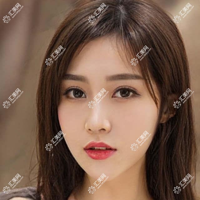 深圳美视眼科揭秘:深湾诊所眼科项目价格大全,近视激光&白内障手术一网打尽