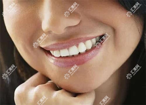 广州牙贝爱口腔全项目价格表:牙套矫正实惠