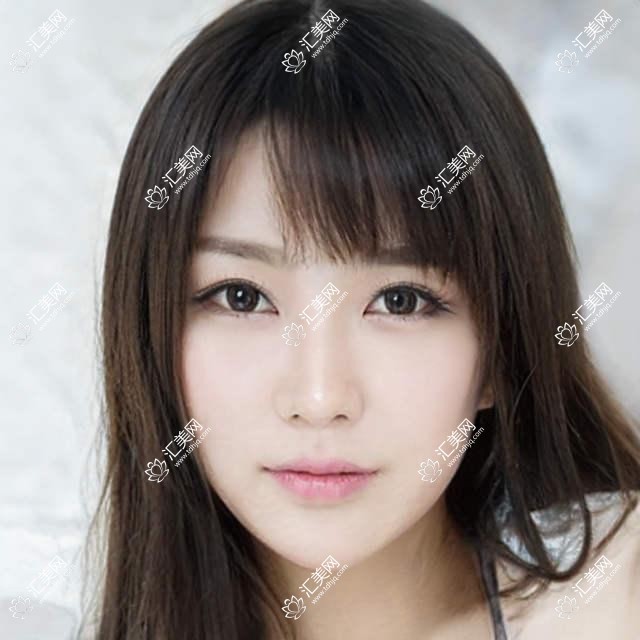 唐山牙齿美学修复医生韩亚春尚书李明燮,精擅全瓷冠即刻种植超薄贴面