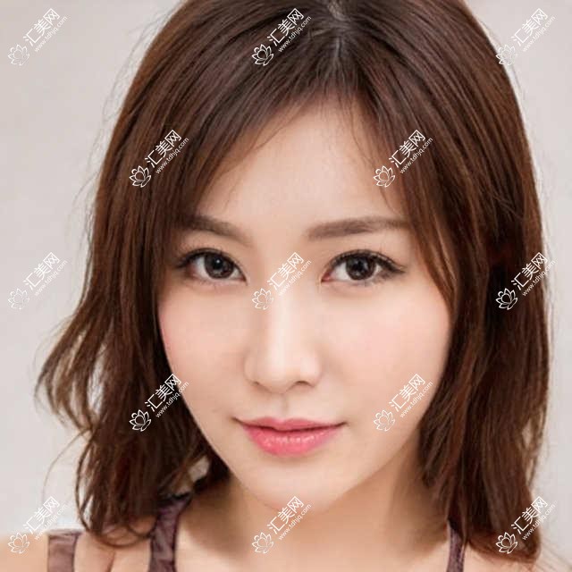北京何氏眼科全项目价格一览:老花远视矫正+白内障手术+全飞秒半飞秒近视+散光PRL TICL ICL晶体+斜视弱视治疗 详询