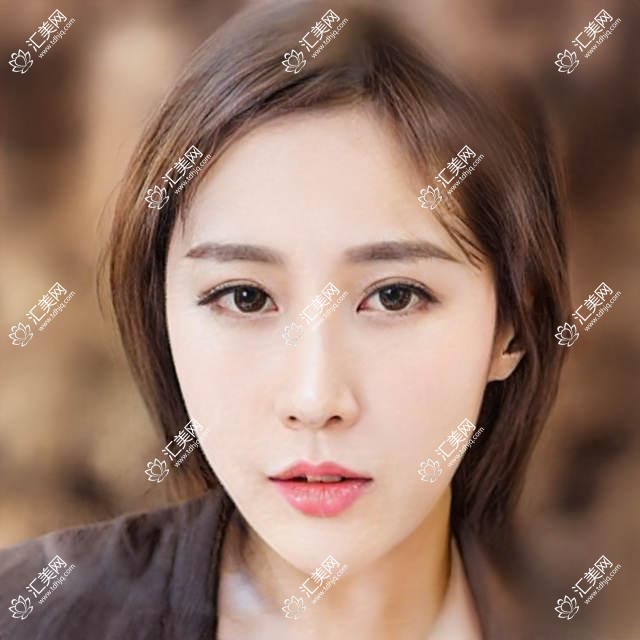 找贵阳这几位牙齿修复医生做美容修复,笑容更添自信