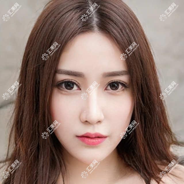 成都华厦眼科全项目价格表:白内障手术+眼健康检查+多项眼科治疗费用一览