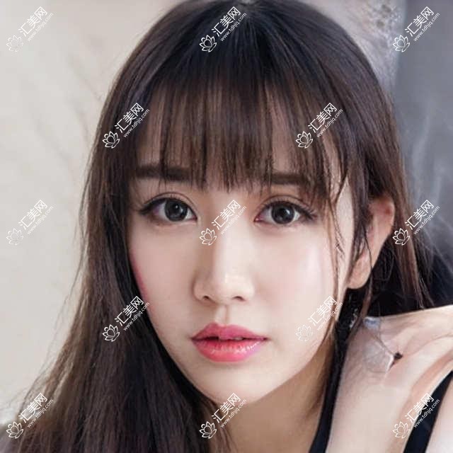 武汉悦瞳眼科全项目揭秘:近视激光&白内障手术&干眼治疗价格一览