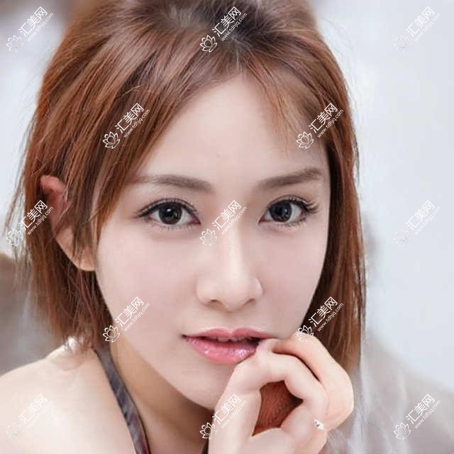 大连ICL矫正医生推荐:赵琪、邵彦,个性化诊疗与万例白内障经验