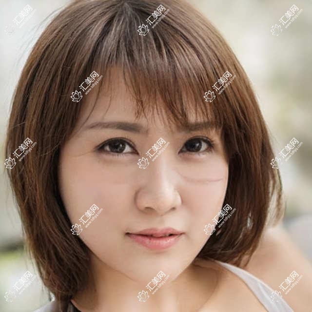 成都青羊萌鹰眼科揭秘：近视矫正&全飞秒&干眼治疗项目价格一览