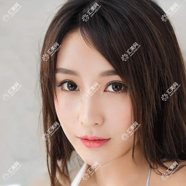 广州希玛眼科全项目价格揭秘:白内障手术+双焦晶体植入