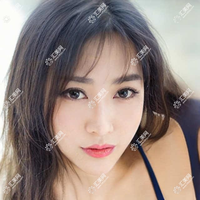 莆田牙齿修复矫正医生朱秀姐评测，海峡整形口碑推荐，冷光美白技术赞