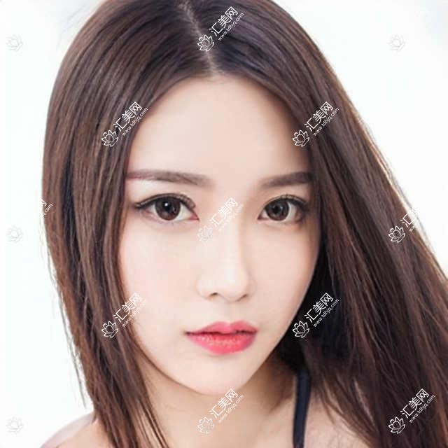 上海中视眼科项目价格揭秘:近视激光1.2W元起,视光矫正8K元起,全飞秒2W元起