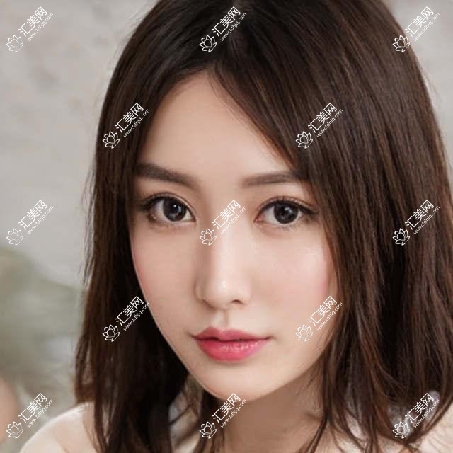 无锡眼科医生推荐:近视手术高手汇聚,黄亮、欧阳朝祜领衔,治近视!