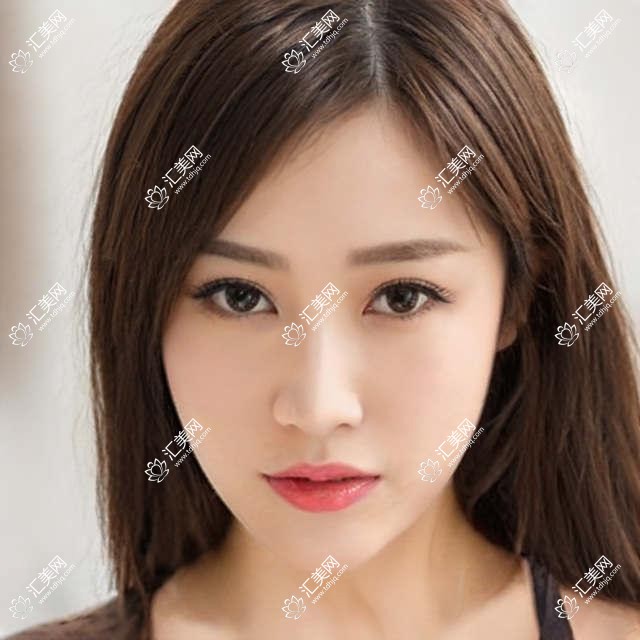 深圳光爱眼科全攻略:近视激光&白内障手术价格一览,透明消费就在这里!