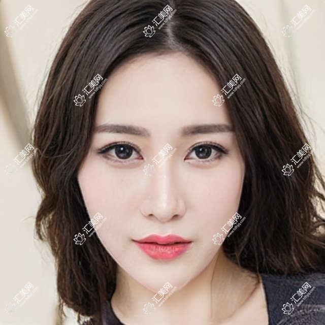 北京口碑佳种植牙医生测评,刘伟涛邱星明刘志杰精擅人工种植